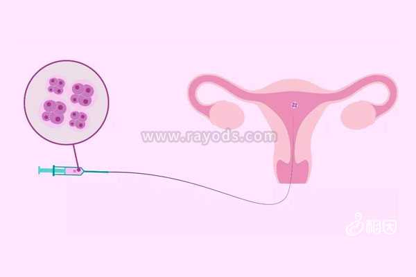 无排卵不孕症_生过孩子切除子宫_做泰国试管婴儿移植怎样的胚胎成功率更高泰